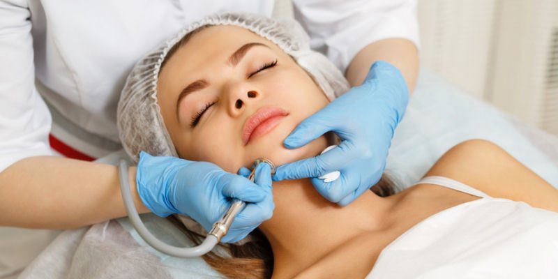 Mikrodermabrasion gegen Pickel und Mitesser Mikrodermabrasion gegen Pickel und Mitesser