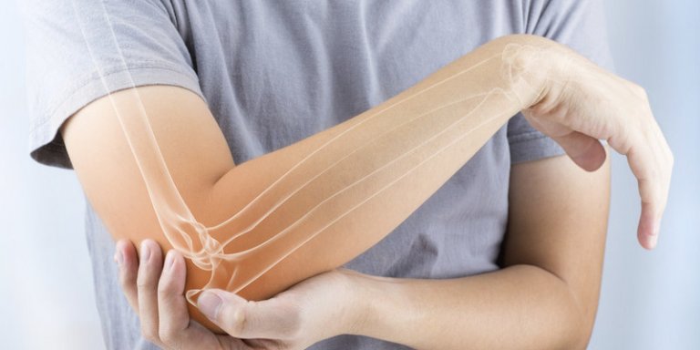 CBD bei rheumatoider Arthritis