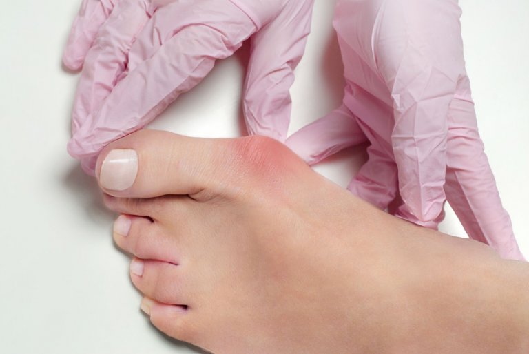 Die besten Hallux Valgus Schienen im Test