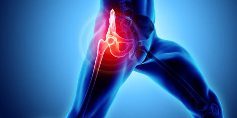 Rheuma Symptome geschwollene Gelenke und Schmerzen