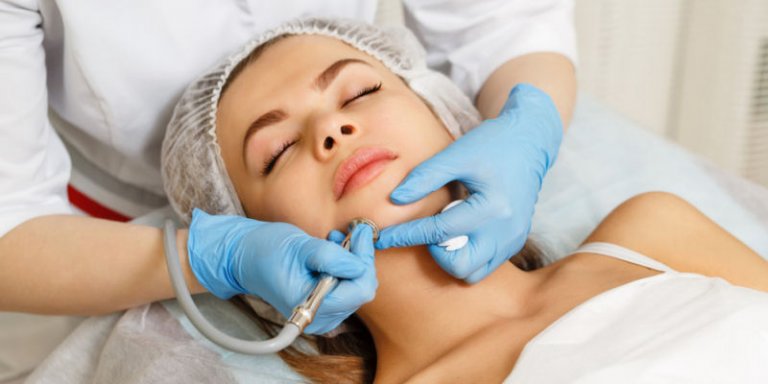 Mikrodermabrasion gegen Pickel und Mitesser